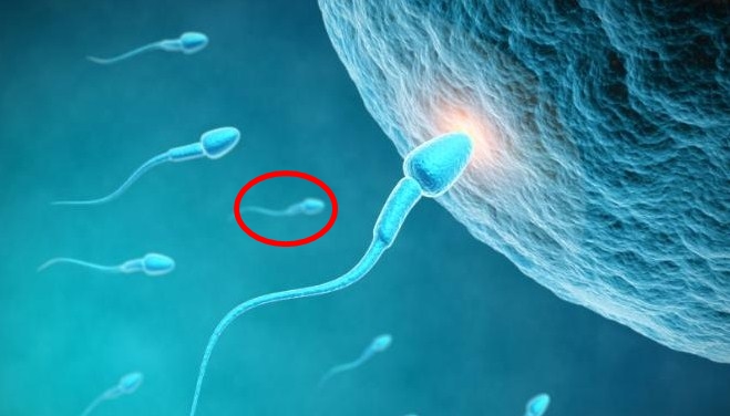 7 Fakta Tentang Kesehatan Sperma